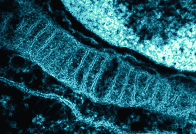 An electron micrograph of a mitochondrion, showing the folded cristae inside it